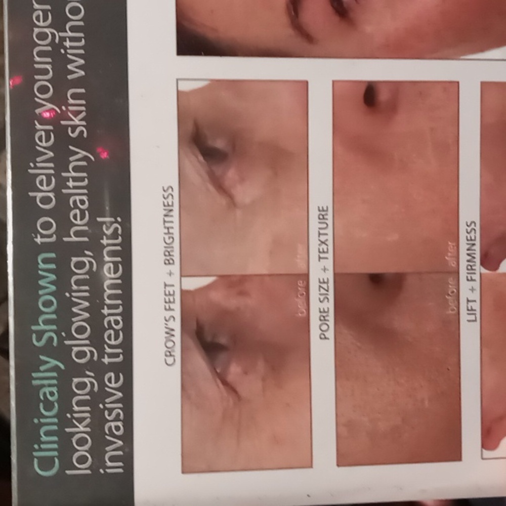 Skin Enhancement System - Picture 4 of 4
